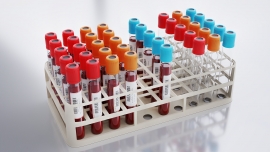 Анализ белков крови может предсказать риск развития 67 заболеваний