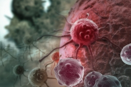 NCL: семь привычек, снижающих риск развития многих видов рака