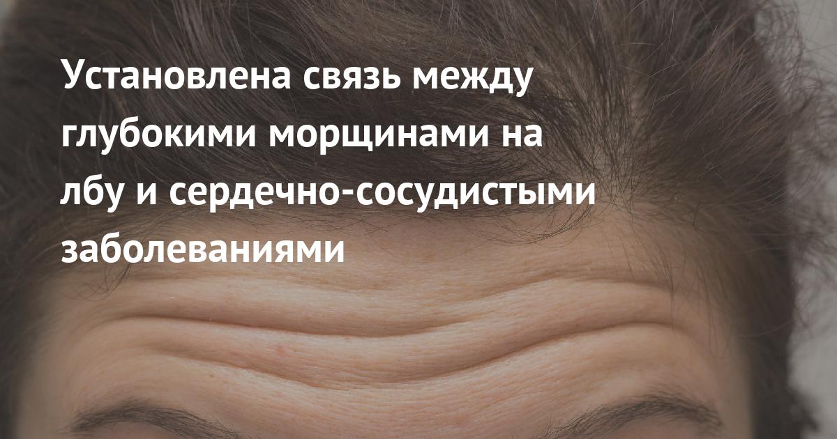 Установите соединение между